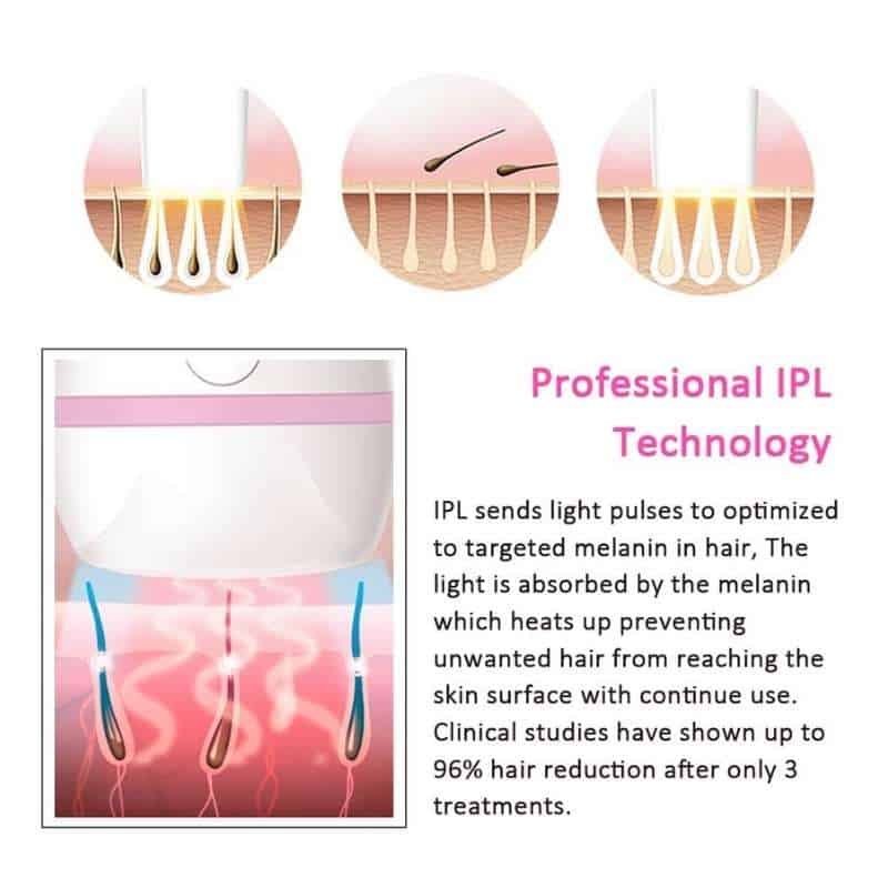 IPL-Permanent-Hair-Removal