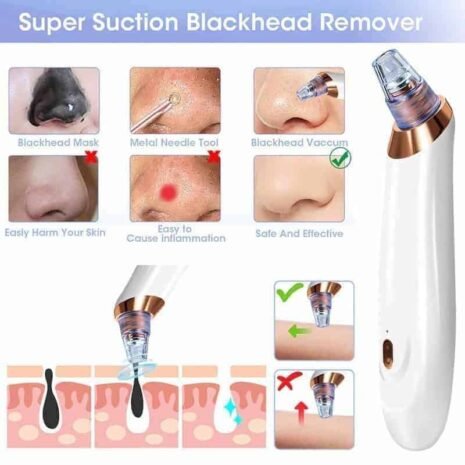 Kit-Face-Steamer-Blackhead-Remover-Vacuum_Smartex-Outlet (7) Face-Steamer